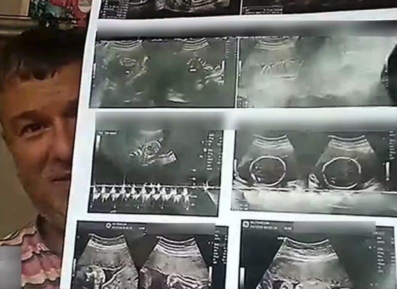 Homem Recebe Laudo Errado de Ultrassom e Descobre 