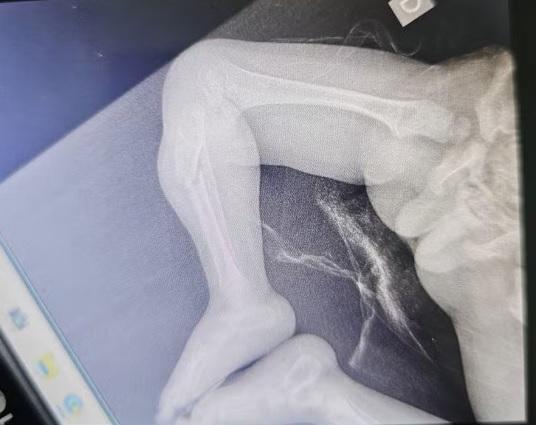 Padrasto é preso após quebrar perna de bebê que 'chorava muito' em Campinas.