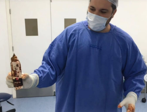 Homem passa por cirurgia após desodorante ser encontrado em sua cavidade retal