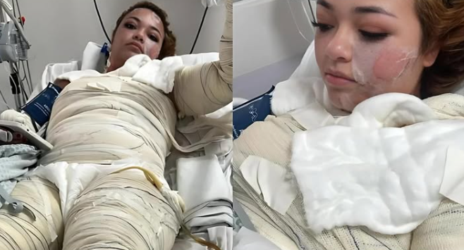 Jovem morre após sofrer queimaduras graves em banheira de motel no Paraná