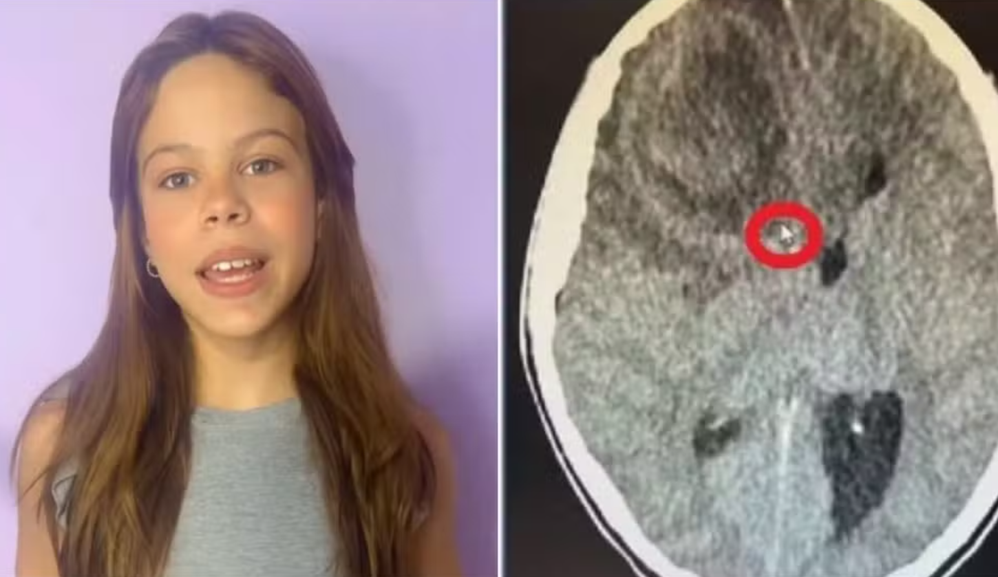 Laudo confirma infecção cerebral como causa da morte de atriz de 11 anos