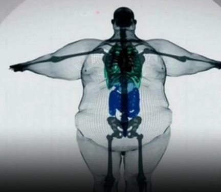 Modelo 3D revela impacto do excesso de peso no corpo humano.