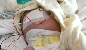 Bebê de 2 meses internado com fraturas graves em Porto Alegre