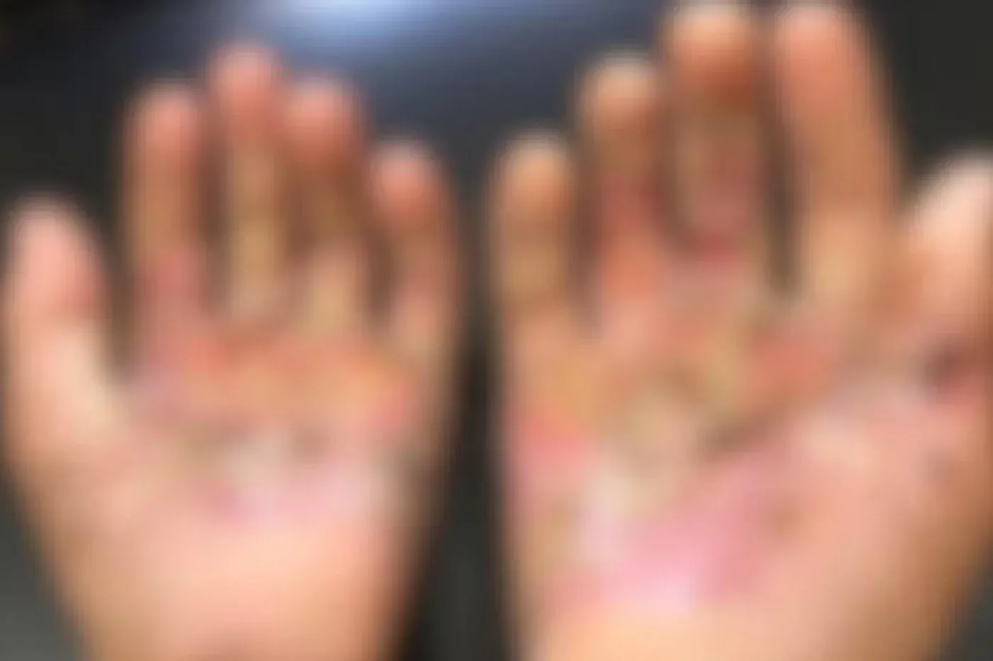 Após queimar mãos do filho no fogão e jogar sal nas feridas mulher é presa no RS