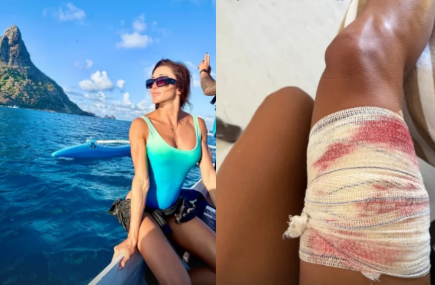Turista é mordida por tubarão-lixa durante mergulho em Fernando de Noronha