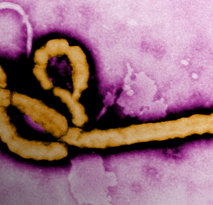 Brasil investiga caso suspeito de ebola em São Paulo