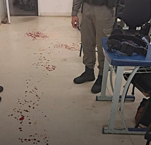 Aluno soldado fica ferido após disparo acidental em escola da Brigada Militar em Porto Alegre