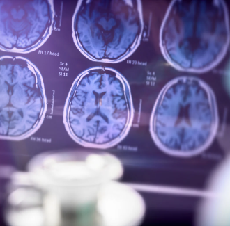 Justiça determina curatela de Fernando Henrique Cardoso após avanço do Alzheimer