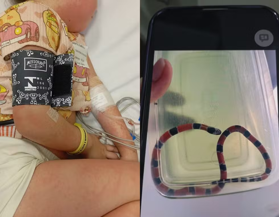Menina de 4 anos sobrevive após picada de cobra-coral e reações alérgicas graves em Santa Catarina