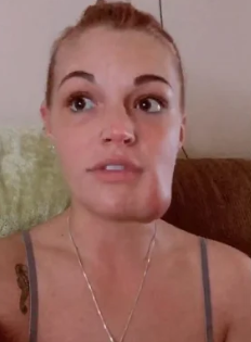 Mulher convive há 19 anos com tumor vascular no rosto e decide dar nome à protuberância