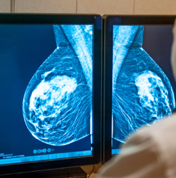 Planos de saúde terão que cobrir mamografia digital sem restrição de idade a partir de outubro
