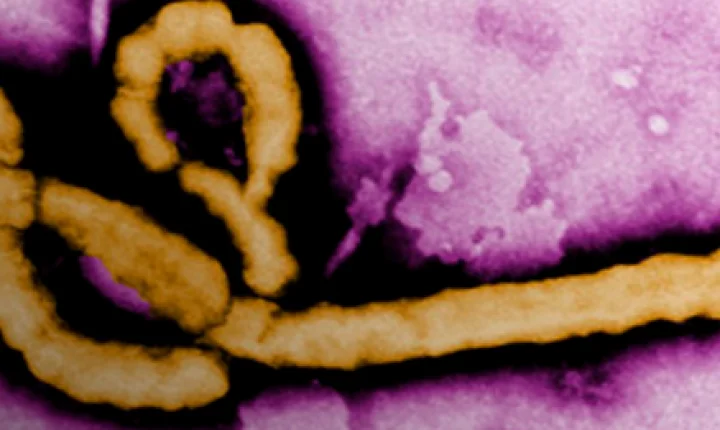 Brasil investiga caso suspeito de ebola em São Paulo
