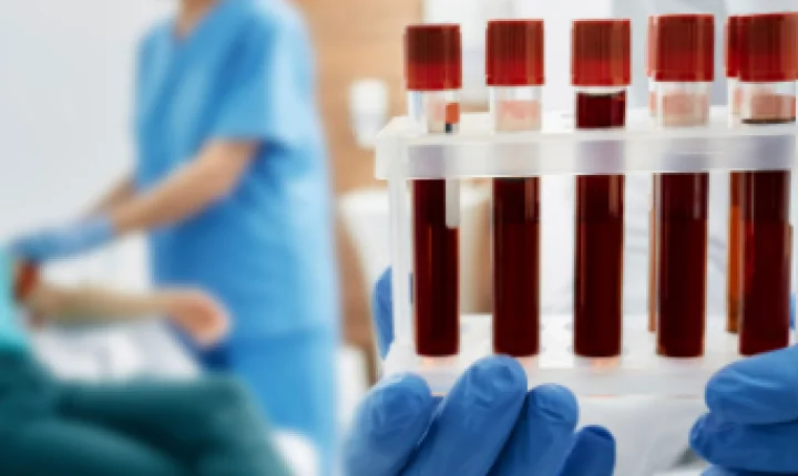Exame de sangue que busca detectar sinais de mais de 50 tipos de câncer chega ao Brasil por R$ 6.990
