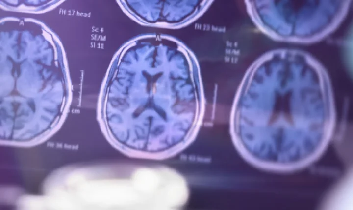 Justiça determina curatela de Fernando Henrique Cardoso após avanço do Alzheimer