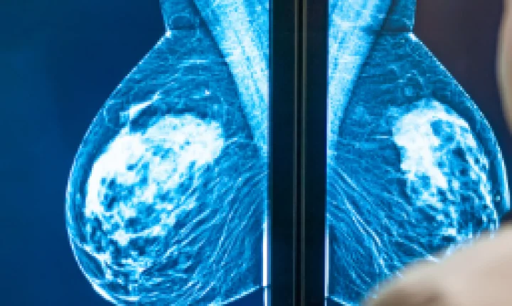 Planos de saúde terão que cobrir mamografia digital sem restrição de idade a partir de outubro